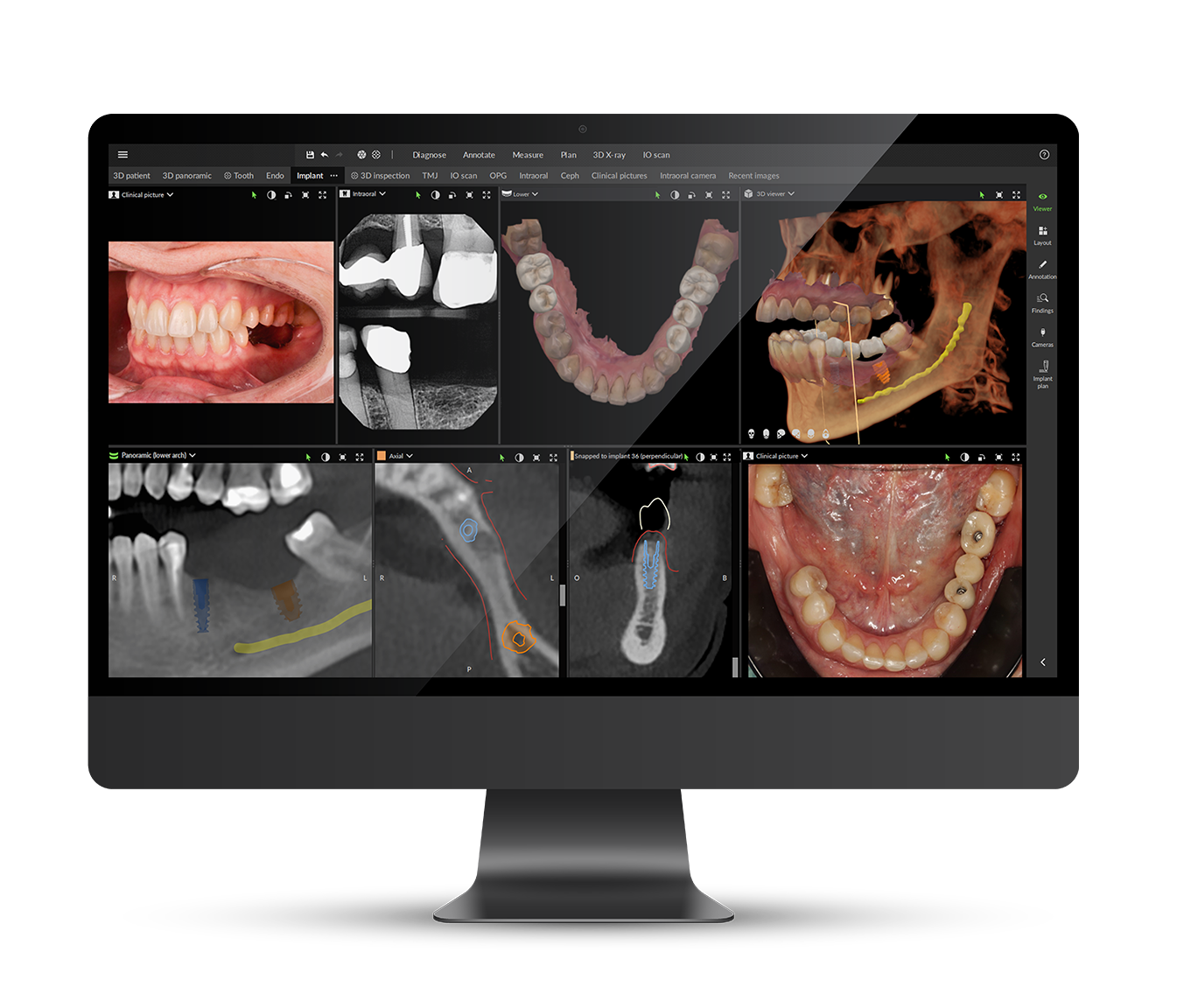 DEXIS digital imaging suite at Dental Hygienics