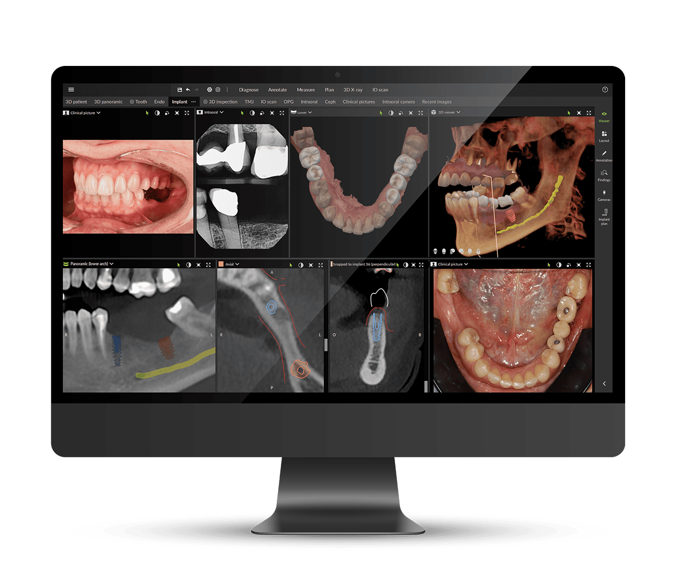 DTX Studio Clinic imaging workspace